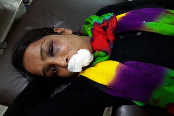 मामूली घरेलू विवाद को लेकर एक व्यक्ति ने अपनी पत्नी को मारपीट कर बुरी तरह घायल कर दिया