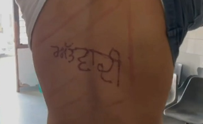 ਸਵਾਲਾਂ ਦੇ ਘੇਰੇ ’ਚ ਬਰਨਾਲਾ ਜੇਲ੍ਹ, ਕੈਦੀ ਵਲੋਂ ਜੇਲ੍ਹ ਸੁਪਰਡੈਂਟ ’ਤੇ ਲਾਏ ਗਏ ਵੱਡੇ ਦੋਸ਼, ਕੈਦੀ ਦੀ ਕੀਤੀ ਕੁੱਟਮਾਰ, ਗਰਮ ਸਰੀਏ ਨਾਲ ਪਿੱਠ ‘ਤੇ ਲਿਖਿਆ ਅੱਤਵਾਦੀ