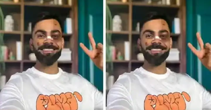 आंख-नाक में चोट देख टेंशन में आए किंग कोहली के फैंस